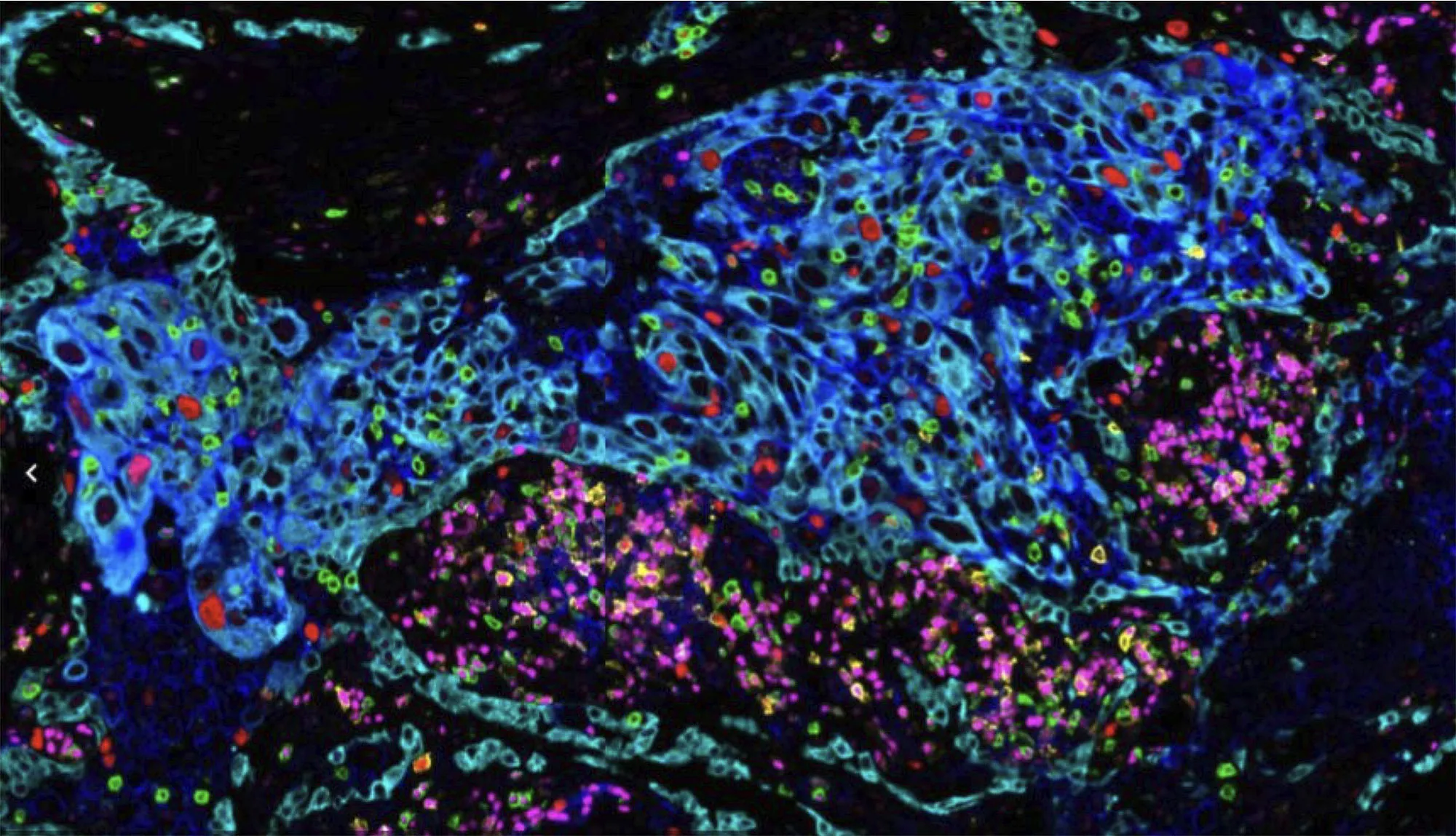 Spatial Core Core Facilities - Harvard Cancer Consortium
